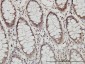 PSMB8 Antibody (monoclonal) (M01)
